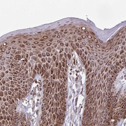 Zfp219 Antibody, Novus Biologicals 25 &mu;L, Unlabeled:Antibodies, Polyclonal